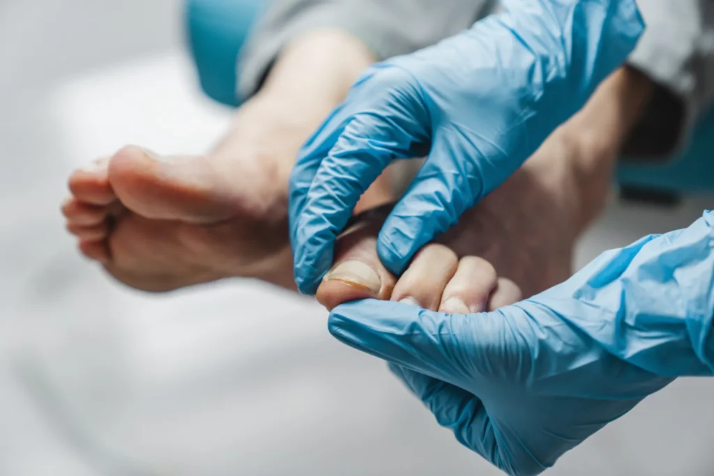 podiatrist treating feet during procedure 2022 06 21 17 47 20 utc